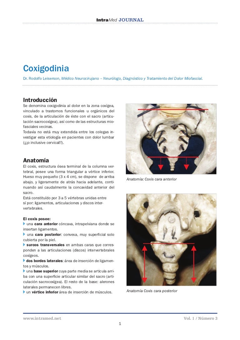 dolor coxis al sentarse y levantarse dolor coxis al sentarse y levantarse